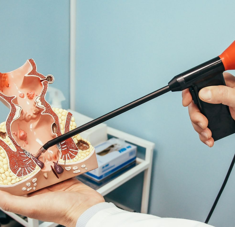 Magma porno festivali